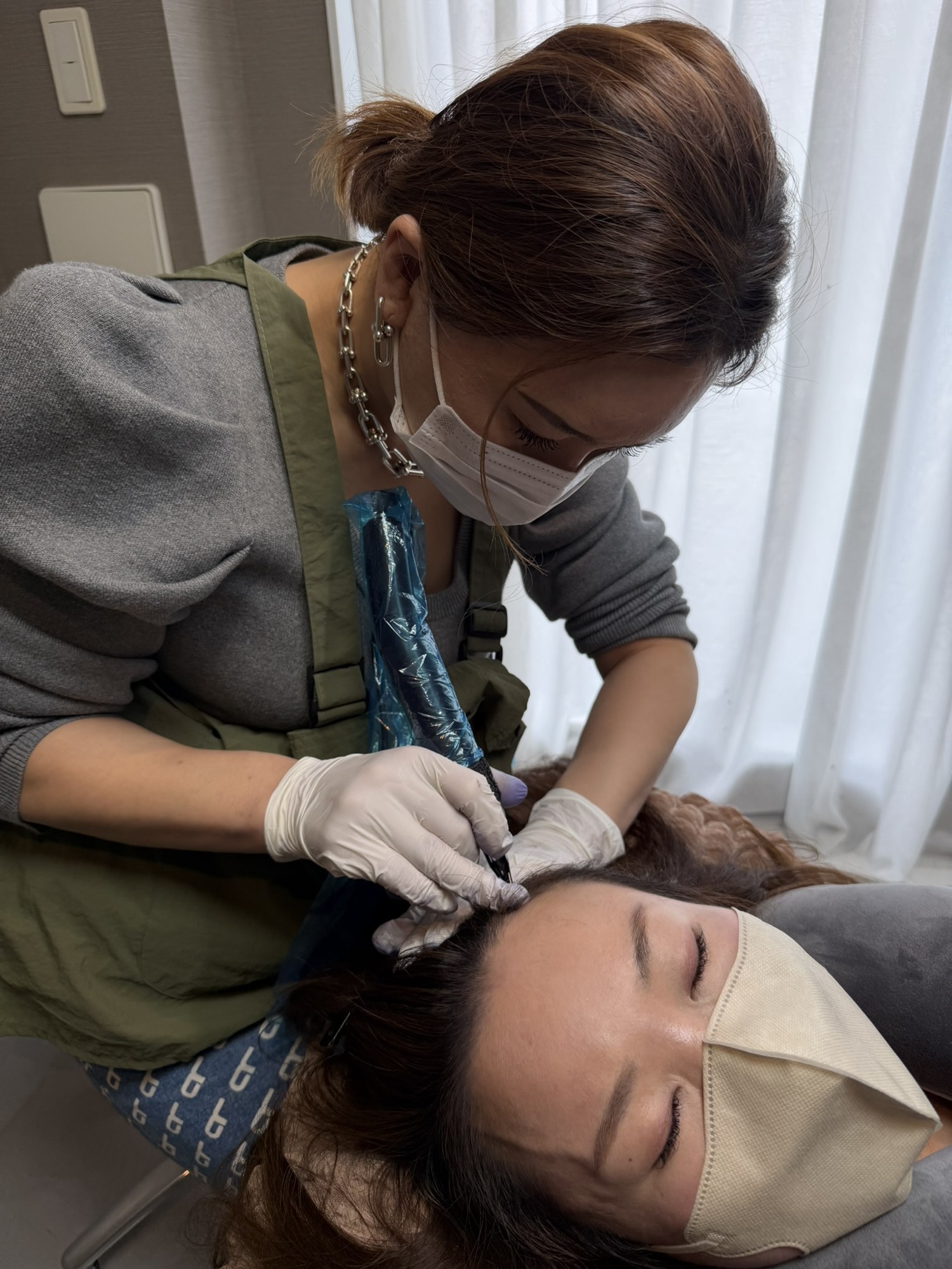 女性の生え際への実際の施術